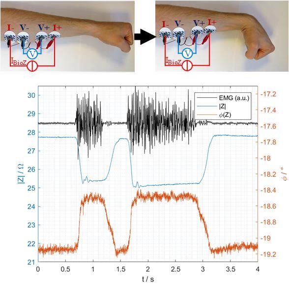 Measurement setup to acquire the muscle contraction during wrist flexions and a plot of the measured raw data of the EMG signal and the complex bioimpedance. The muscle contraction was performed two times. In comparison to the EMG signal, it can be seen, that especially the beginning of the contraction can also easily be detected by performing bioimpedance measurements.