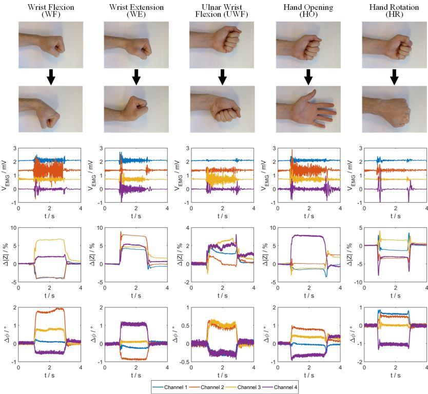 Measurement result of five typical hand gestures, using the four measurement modules simultaneously. Each muscle contraction was performed for a duration of about 2 s. In the plots below the corresponding photographs, the EMG signals as well as the bioimpedance magnitudes and phases are shown. The EMG data was preprocessed by a digital 50 Hz notch filter, whereas the impedance signals have not been filtered digitally. Comparing the resulting plots leads to the conclusion that the magnitude and phase signals of the bioimpedance provide additional useful information about muscle contractions. Additionally, hand gestures which are difficult to detect via EMG measurements, for example the hand rotation (HR), can be recognized via bioimpedance measurements reliably